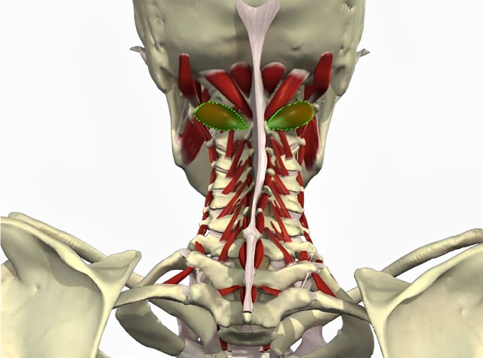 vertebral arteriya sindromi